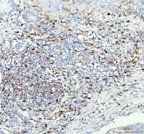 2 - Anti-CD74 Rabbit Monoclonal Antibody ABO13520