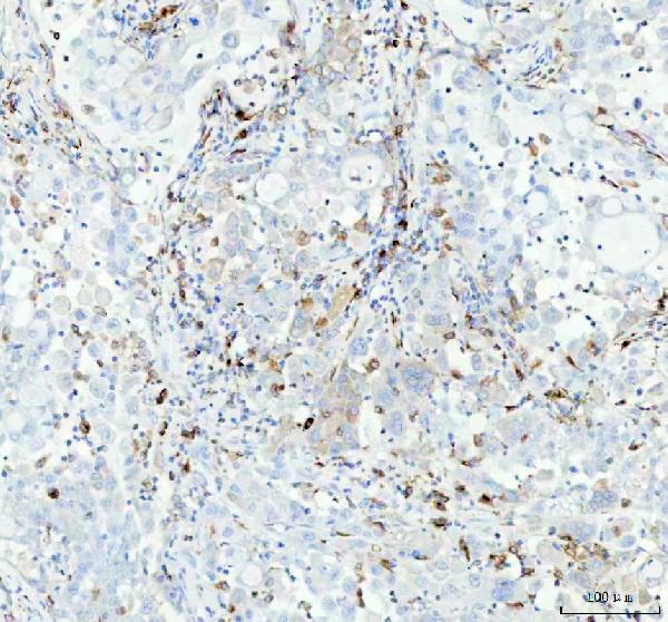 2 - Anti-CD74 Rabbit Monoclonal Antibody ABO13520