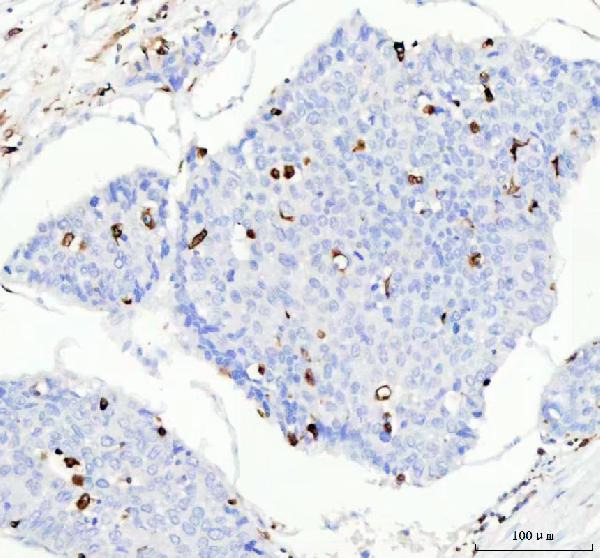 2 - Anti-CD74 Rabbit Monoclonal Antibody ABO13520