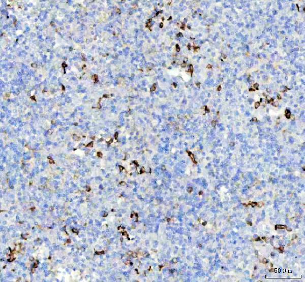 2 - Anti-CD74 Rabbit Monoclonal Antibody ABO13520