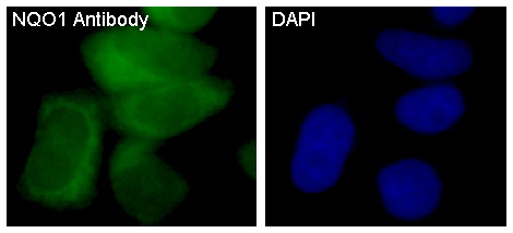3 - Anti-NQO1/Dt Diaphorase Rabbit Monoclonal Antibody ABO13522