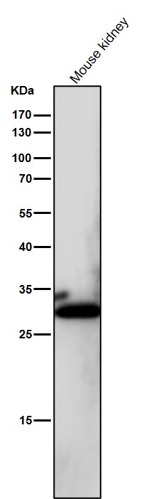 1 - Anti-NQO1/Dt Diaphorase Rabbit Monoclonal Antibody ABO13522
