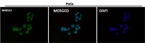 1 - Anti-CTCF Rabbit Monoclonal Antibody ABO13523