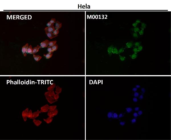 1 - Anti-CTCF Rabbit Monoclonal Antibody ABO13523