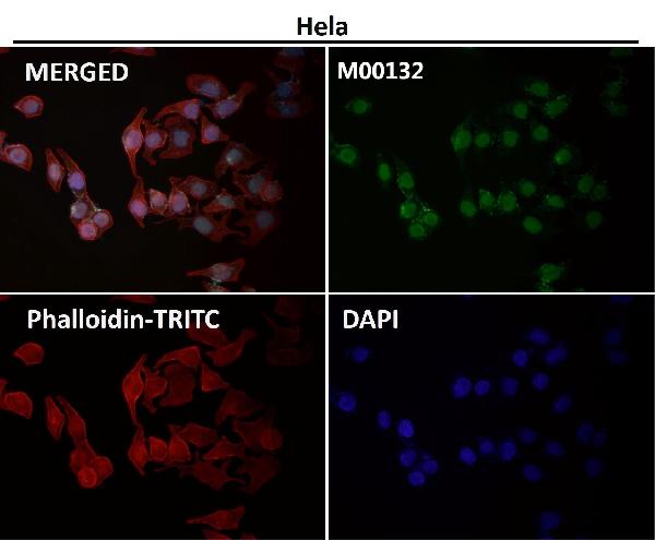 1 - Anti-CTCF Rabbit Monoclonal Antibody ABO13523