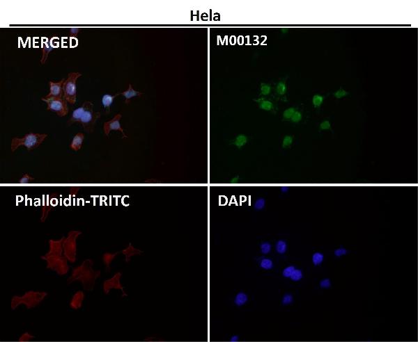 1 - Anti-CTCF Rabbit Monoclonal Antibody ABO13523