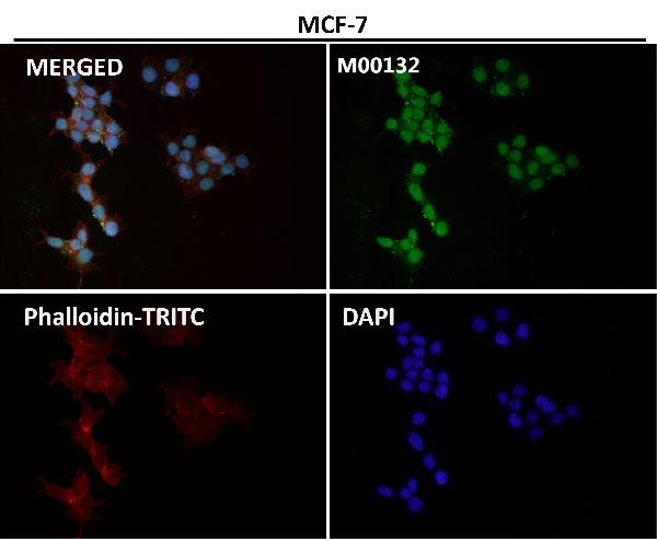 1 - Anti-CTCF Rabbit Monoclonal Antibody ABO13523