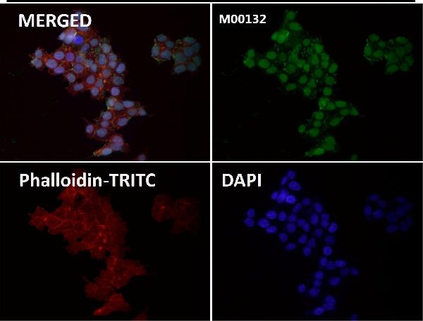 1 - Anti-CTCF Rabbit Monoclonal Antibody ABO13523
