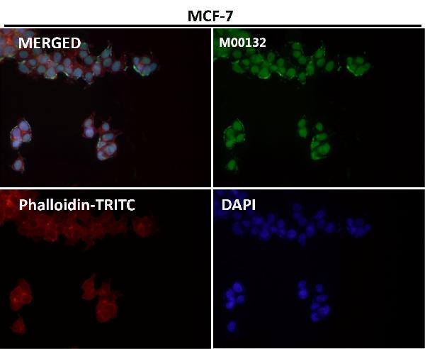 1 - Anti-CTCF Rabbit Monoclonal Antibody ABO13523