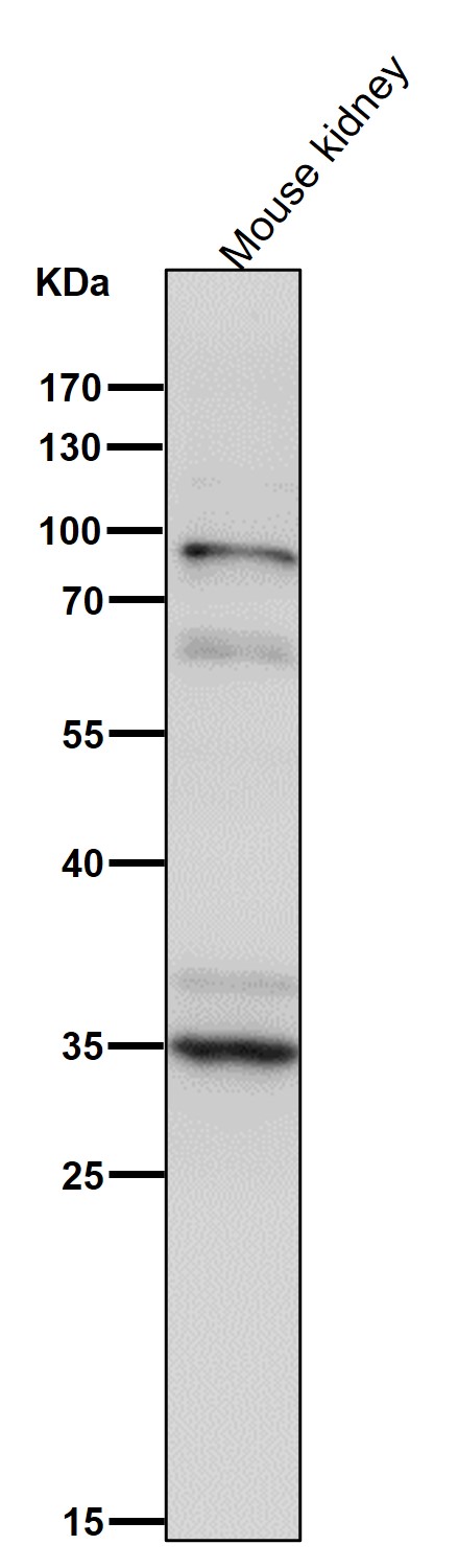1 - Anti-XBP1 Rabbit Monoclonal Antibody ABO13524