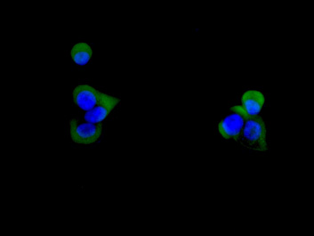 3 - Anti-CD59 Rabbit Monoclonal Antibody ABO13527