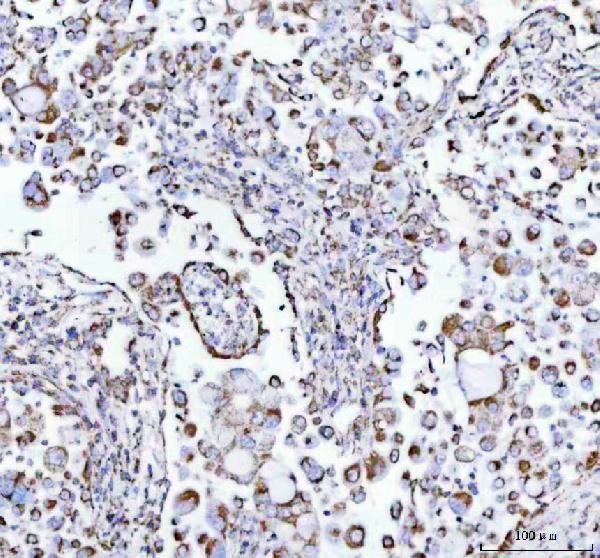 2 - Anti-ATPB Rabbit Monoclonal Antibody ABO13533