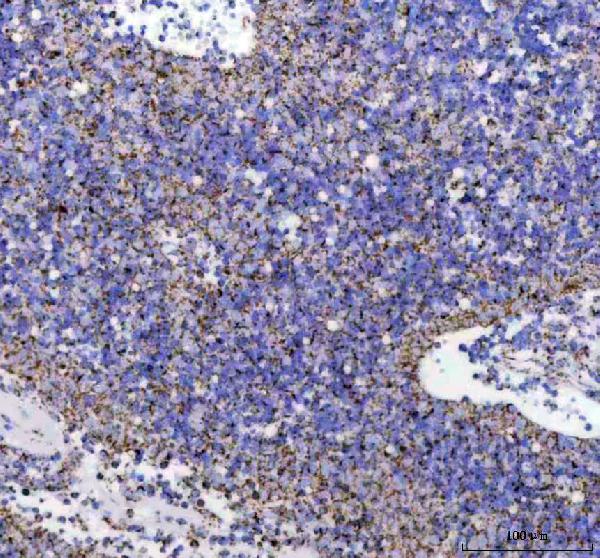 2 - Anti-ATPB Rabbit Monoclonal Antibody ABO13533