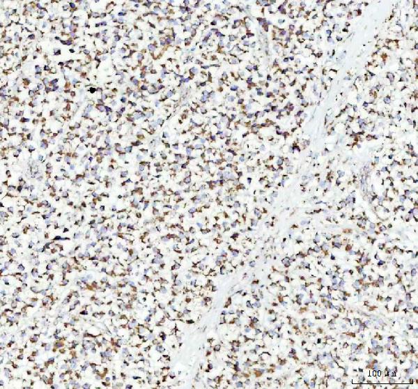 2 - Anti-ATPB Rabbit Monoclonal Antibody ABO13533
