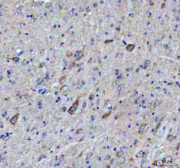 2 - Anti-ATPB Rabbit Monoclonal Antibody ABO13533