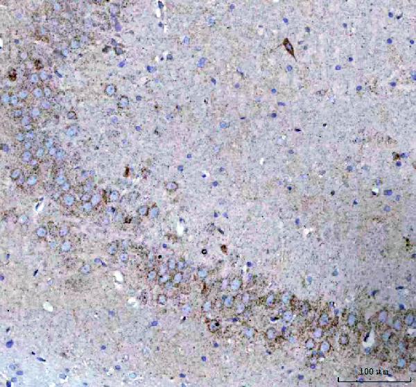 2 - Anti-ATPB Rabbit Monoclonal Antibody ABO13533