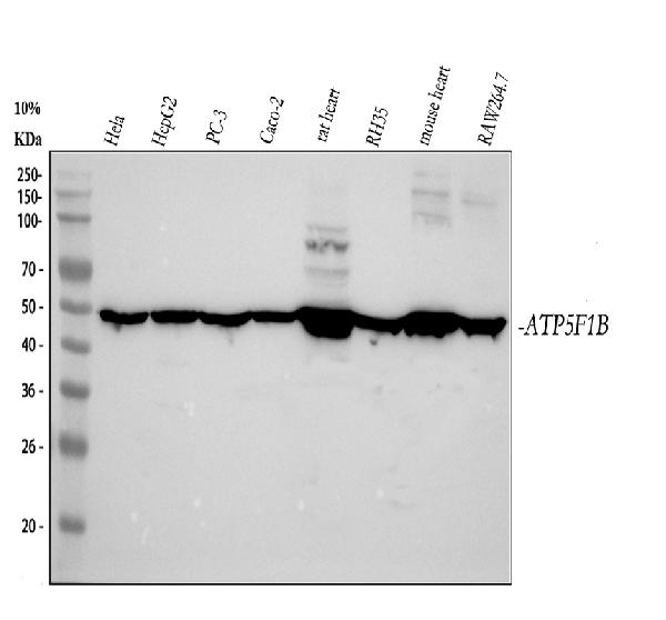 1 - Anti-ATPB Rabbit Monoclonal Antibody ABO13533
