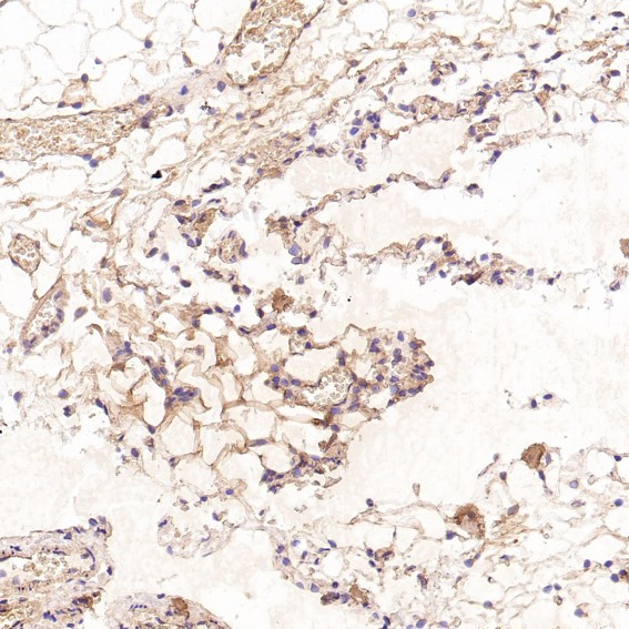 2 - Anti-CD41 ITGA2B Rabbit Monoclonal Antibody ABO13538