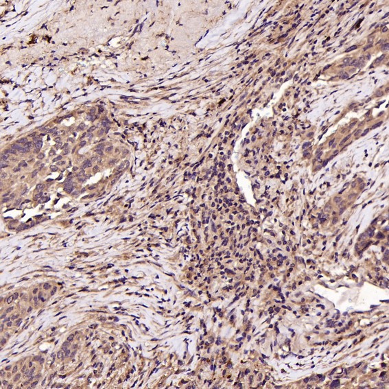 2 - Anti-CD41 ITGA2B Rabbit Monoclonal Antibody ABO13538