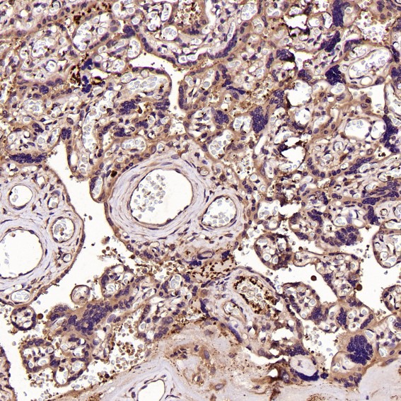 2 - Anti-CD41 ITGA2B Rabbit Monoclonal Antibody ABO13538