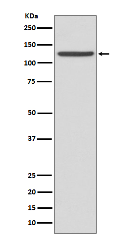 1 - Anti-CD41 ITGA2B Rabbit Monoclonal Antibody ABO13538