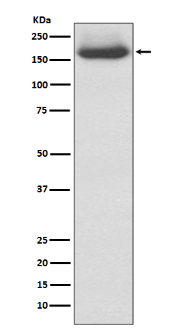 1 - Anti-NEFM/Nf M Rabbit Monoclonal Antibody ABO13539
