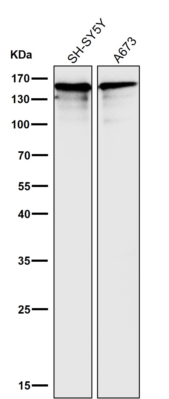 1 - Anti-NEFM/Nf M Rabbit Monoclonal Antibody ABO13539