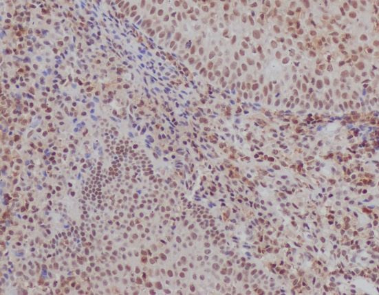 2 - Anti-Ku70 XRCC6 Rabbit Monoclonal Antibody ABO13542