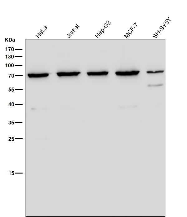1 - Anti-Ku70 XRCC6 Rabbit Monoclonal Antibody ABO13542