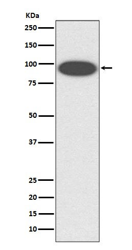 1 - Anti-CD18 ITGB2 Rabbit Monoclonal Antibody ABO13543