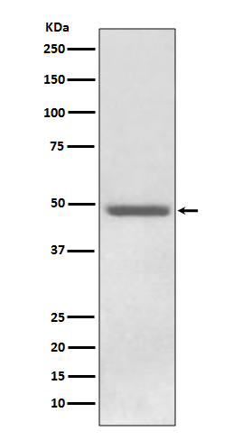 1 - Anti-ADFP PLIN2 Rabbit Monoclonal Antibody ABO13544