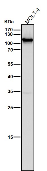 1 - Anti-CD26/DPP4 Rabbit Monoclonal Antibody ABO13547