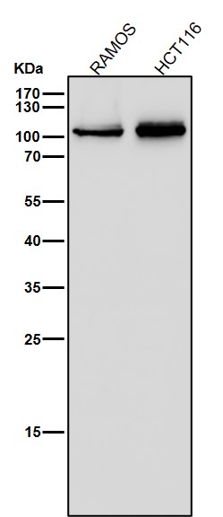 1 - Anti-CD26/DPP4 Rabbit Monoclonal Antibody ABO13547
