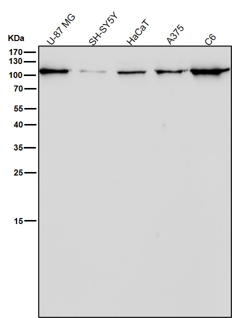 1 - Anti-CD26/DPP4 Rabbit Monoclonal Antibody ABO13547