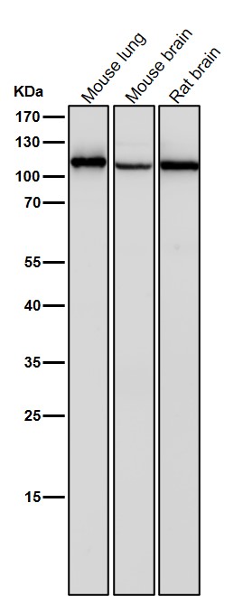 1 - Anti-CD26/DPP4 Rabbit Monoclonal Antibody ABO13547