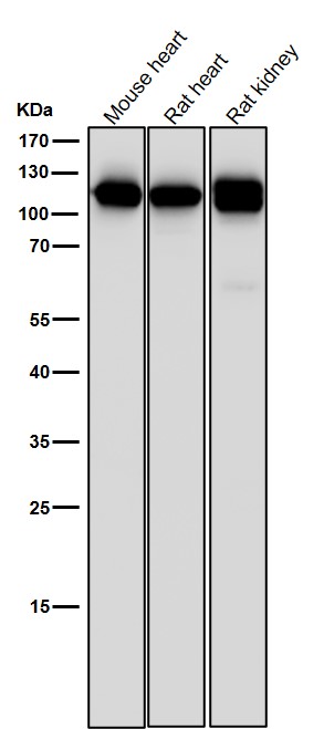 1 - Anti-CD26/DPP4 Rabbit Monoclonal Antibody ABO13547