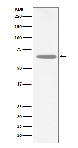 1 - Anti-CHAT/Choline Acetyltransferase Rabbit Monoclonal Antibody ABO13549
