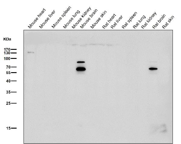 1 - Anti-CHAT/Choline Acetyltransferase Rabbit Monoclonal Antibody ABO13549