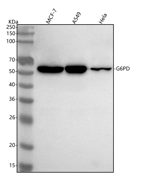 1 - Anti-G6PD/Glucose 6 Phosphate Dehydrogenase Rabbit Monoclonal Antibody ABO13552