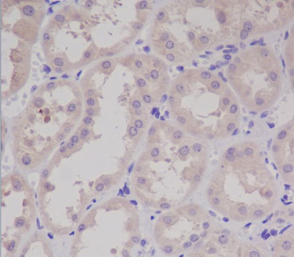 2 - Anti-S100 S100A1 Rabbit Monoclonal Antibody ABO13553