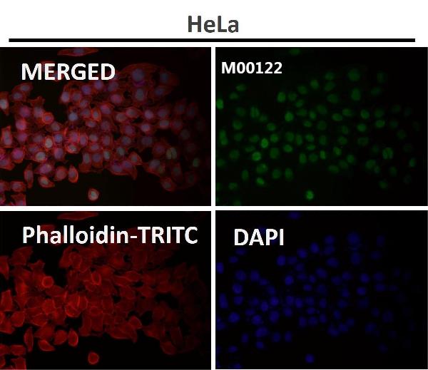 1 - Anti-PARP PARP1 Rabbit Monoclonal Antibody ABO13554
