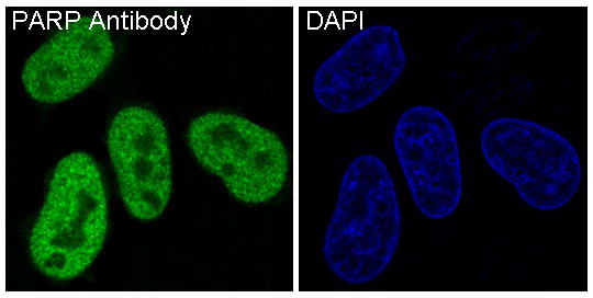 3 - Anti-PARP PARP1 Rabbit Monoclonal Antibody ABO13554