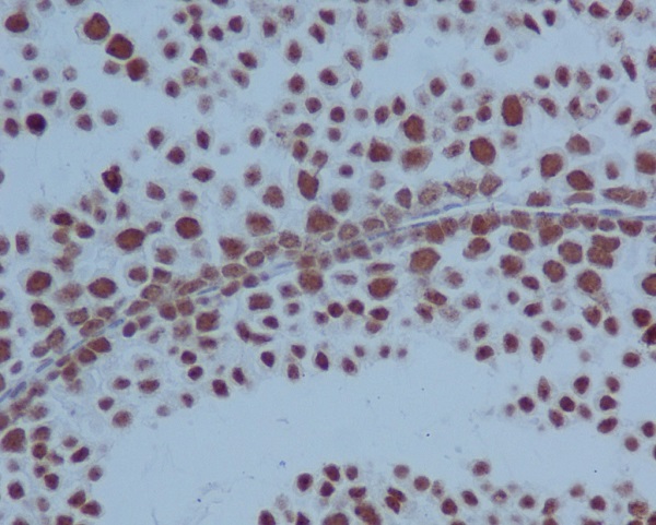 2 - Anti-PARP PARP1 Rabbit Monoclonal Antibody ABO13554