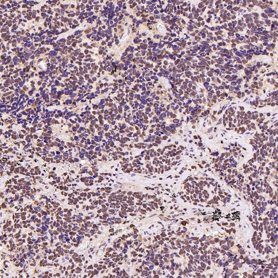 2 - Anti-PARP PARP1 Rabbit Monoclonal Antibody ABO13554