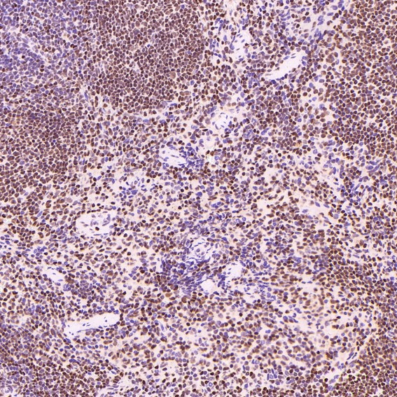 2 - Anti-PARP PARP1 Rabbit Monoclonal Antibody ABO13554