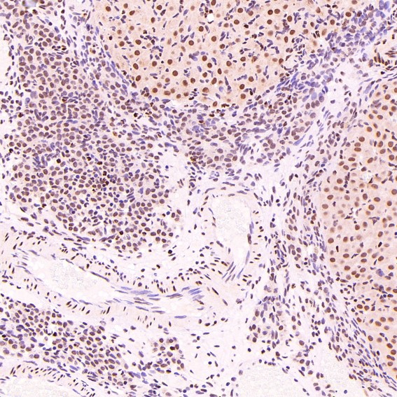 2 - Anti-PARP PARP1 Rabbit Monoclonal Antibody ABO13554