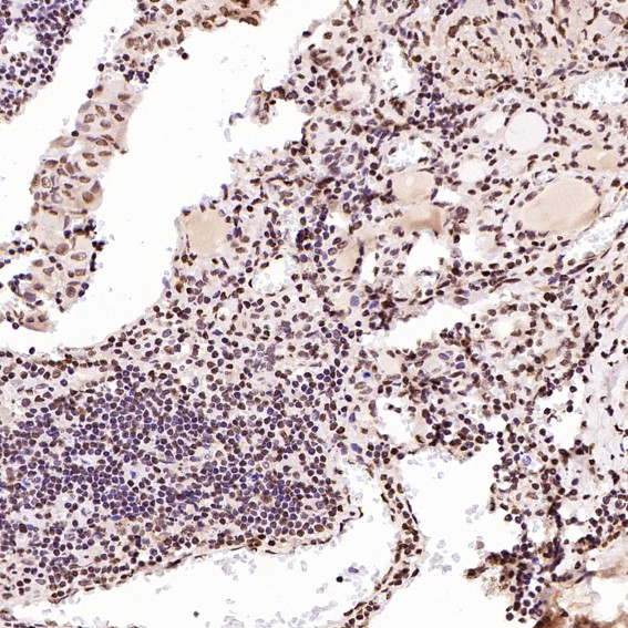 2 - Anti-PARP PARP1 Rabbit Monoclonal Antibody ABO13554