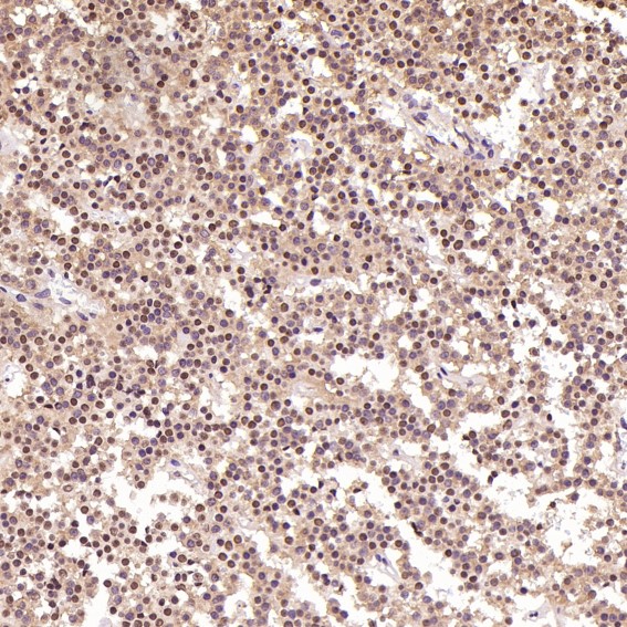 2 - Anti-PARP PARP1 Rabbit Monoclonal Antibody ABO13554