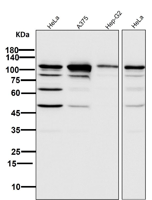 1 - Anti-PARP PARP1 Rabbit Monoclonal Antibody ABO13554