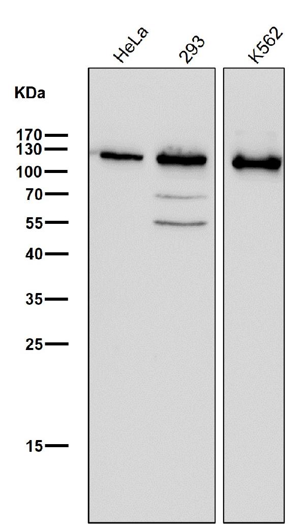 1 - Anti-PARP PARP1 Rabbit Monoclonal Antibody ABO13554